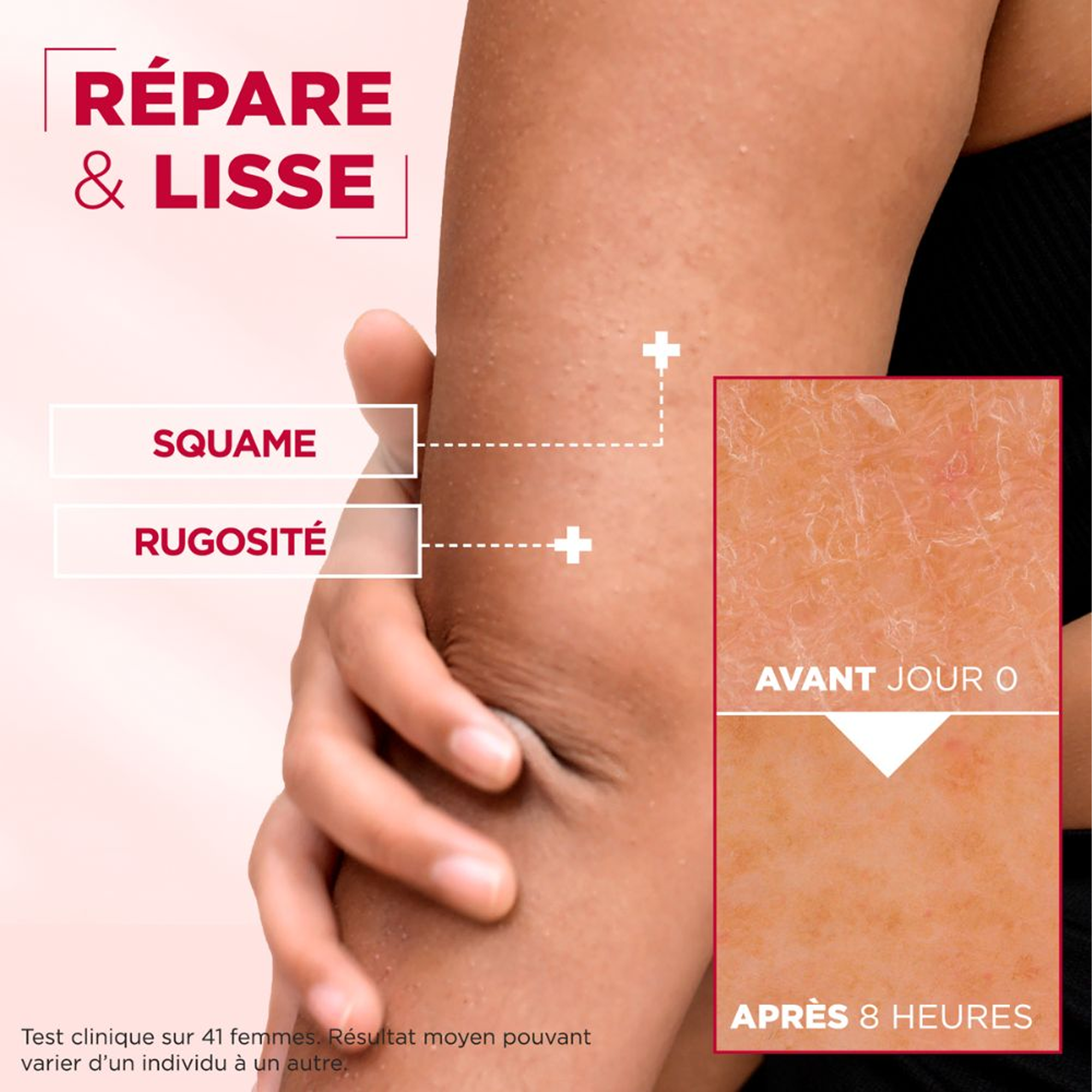 Mixa – Crème Cica Réparation (Visage, Corps & Mains)
