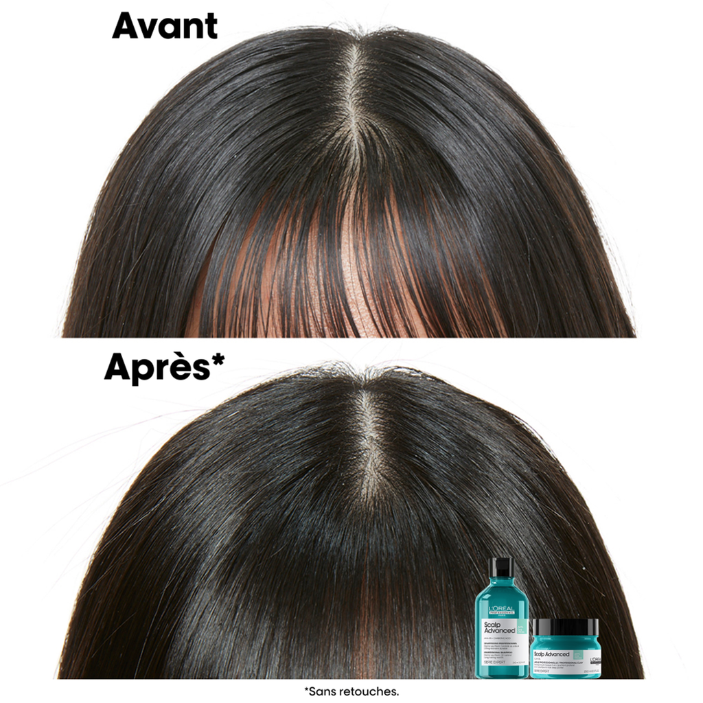 Scalp Advanced - Shampoing dermo-purifiant Anti-gras ( 300ml )