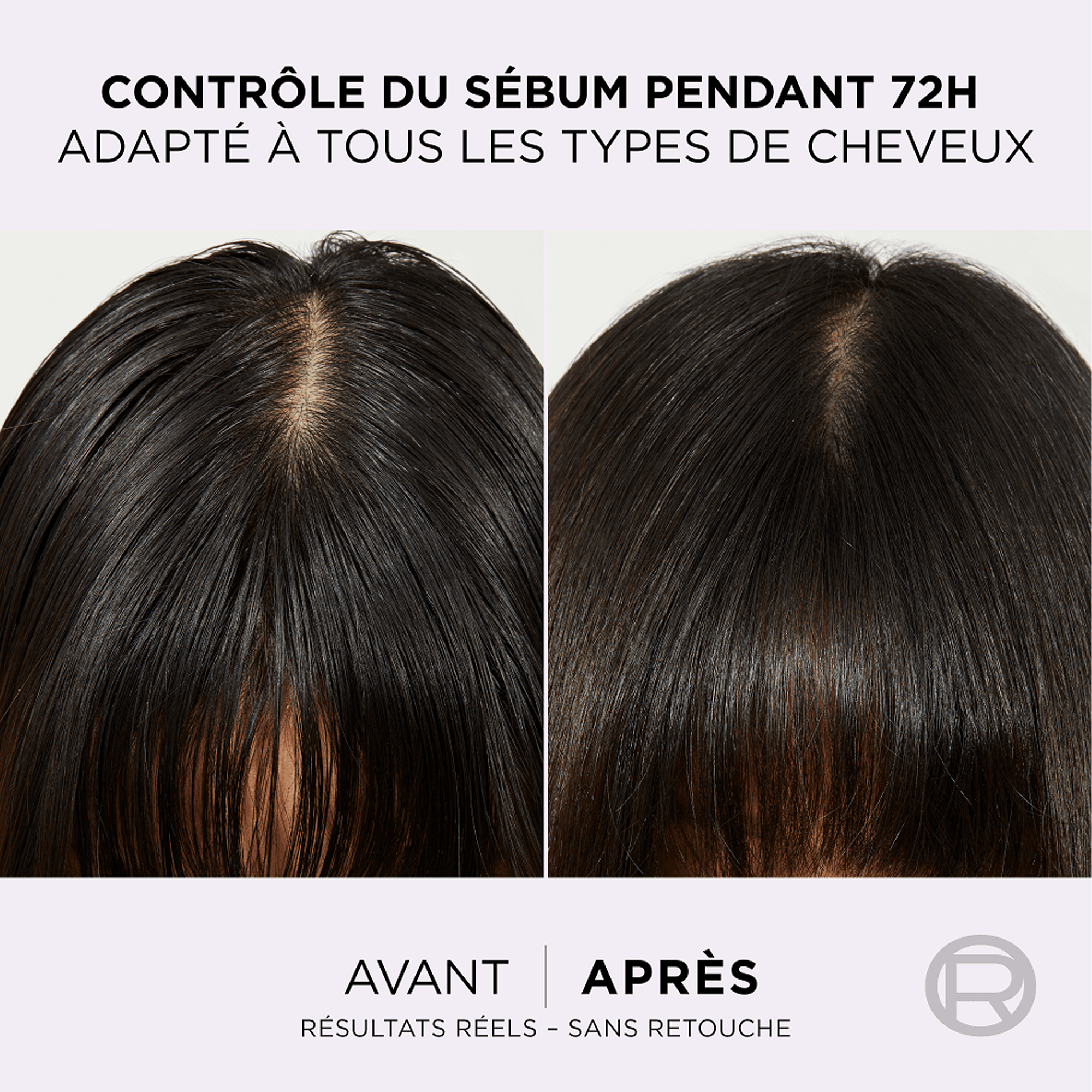 L'Oréal Paris – Elseve Hyaluron Pure Après-Shampooing Démêlant Réhydratant 72H (200 ml)