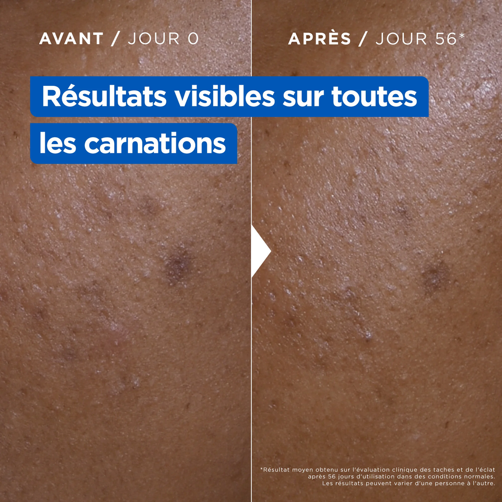 Mixa – Crème Niacinamide Correction Éclat – Visage, Corps & Mains